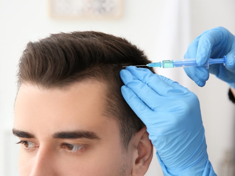 extreme hair loss